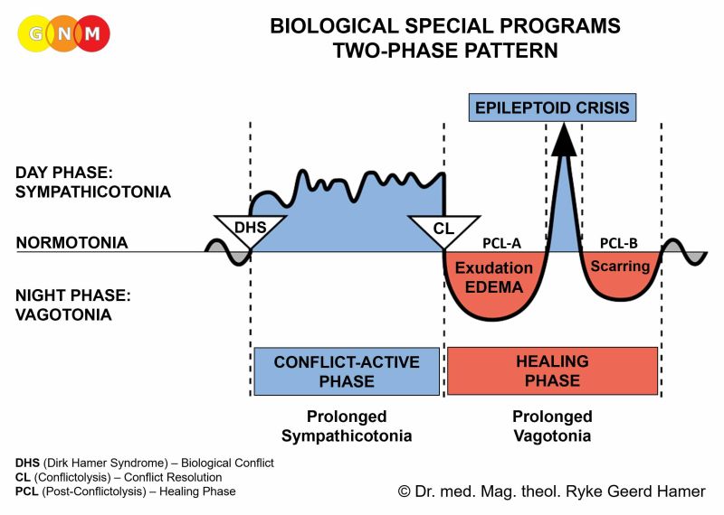 Fases de la enfermedad&nbsp;PCL